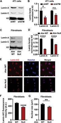 ATM Modulates Nuclear Mechanics by Regulating Lamin A Levels